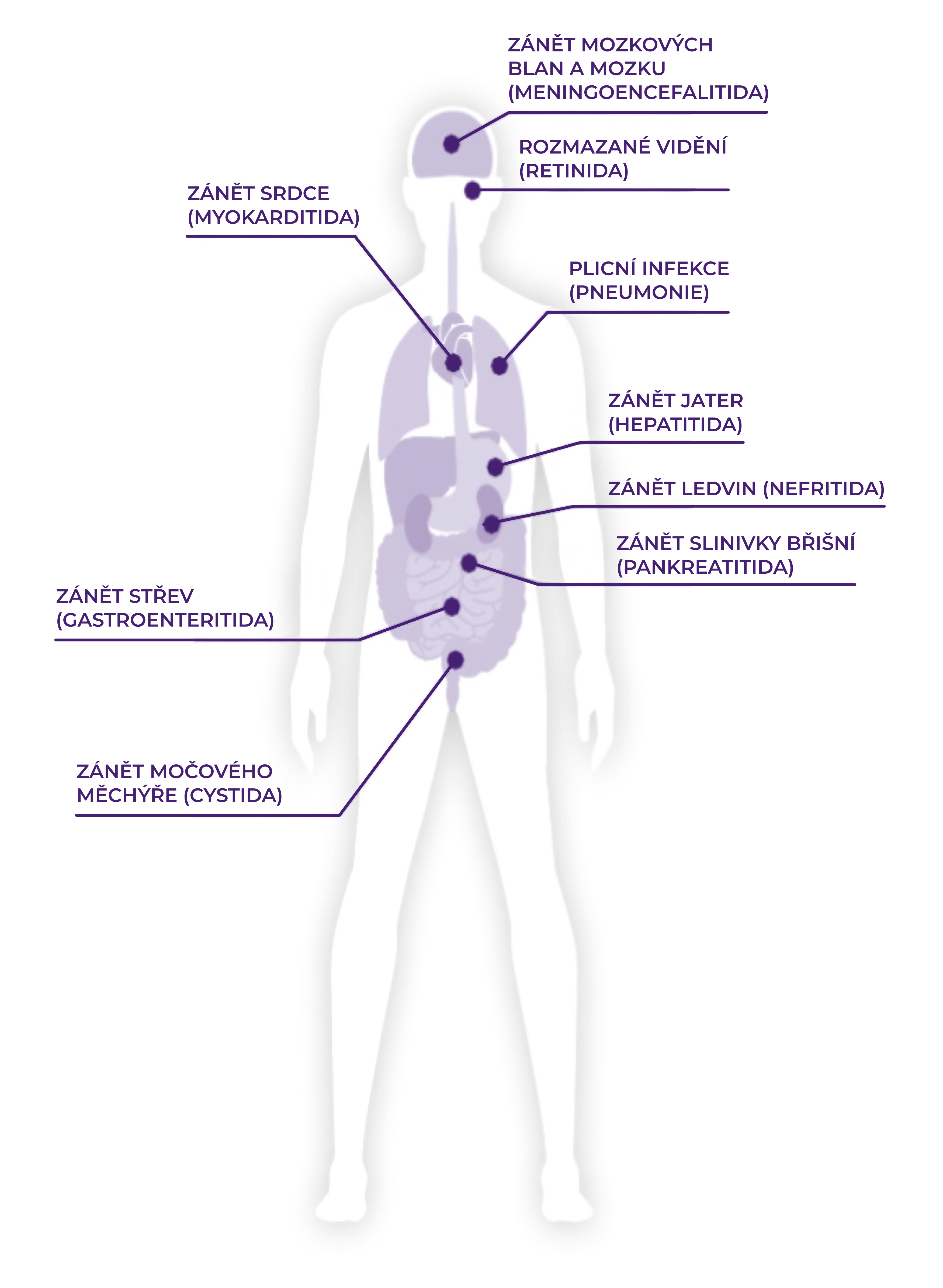 Klinické příznaky
